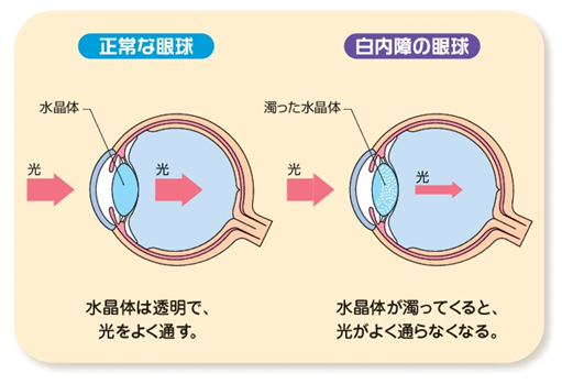 眼球20181004174148691335ff528