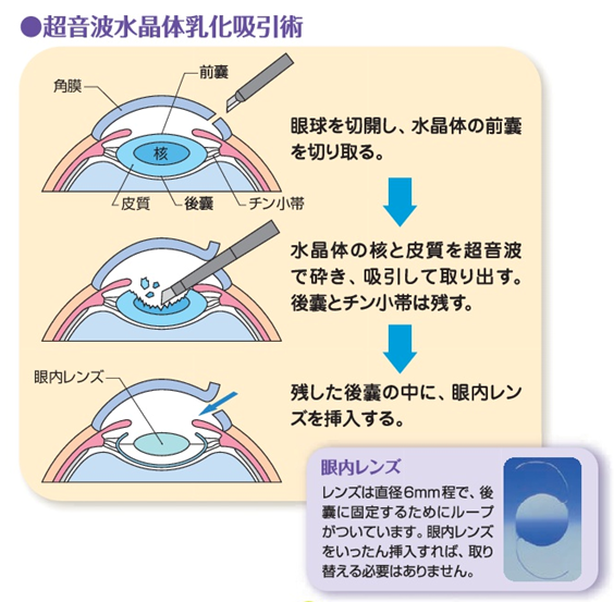 手術201810041749308735434f8eb