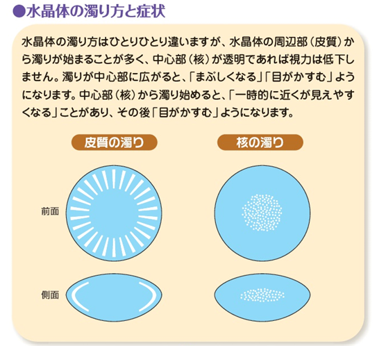 水晶体20181004174733745a09982d9