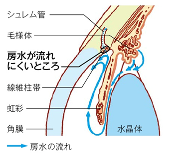 緑内障２20181005075938378c12491ca