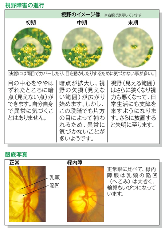 進行201810050758527027b4e6d89