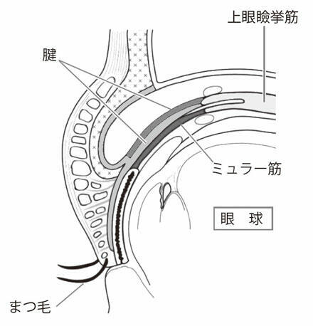 断面図06-1
